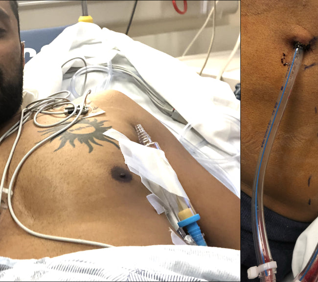 Kaivan in hospital
