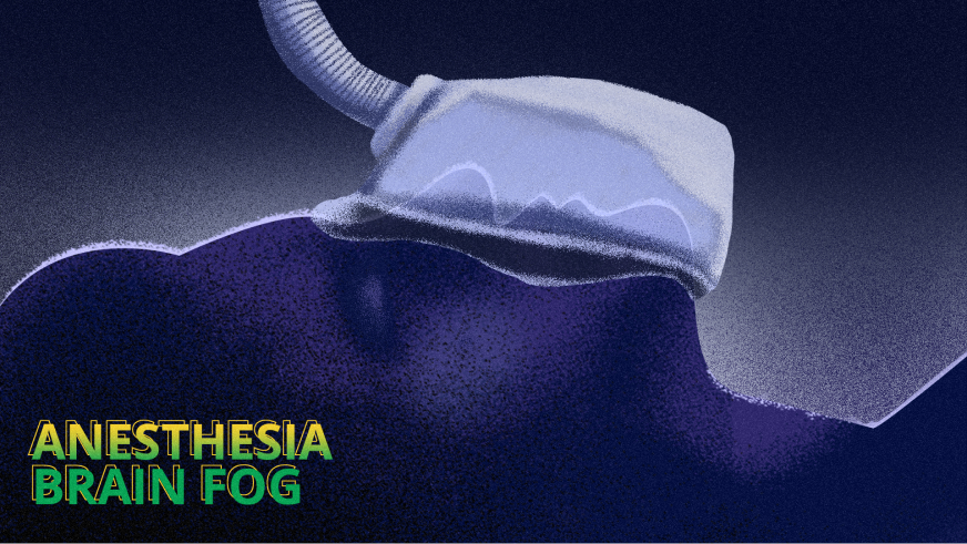 How to Get Rid of Brain Fog after Surgery (from Anesthesia)? How to Get Rid of Brain Fog after Surgery (from Anesthesia)?